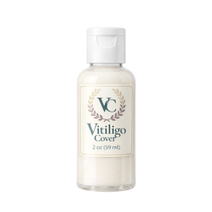 Vitiligo Cover Lotion Shop | Water-Resistant Skin-Tone Blending Lotion 1 2 oz bottle of Vitiligo Cover Lotion